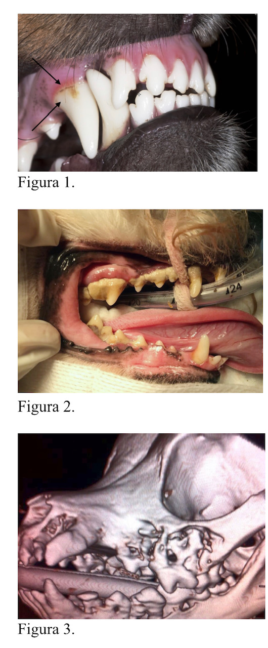 enfermedad periodontal