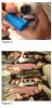 enfermedad periodontal 2