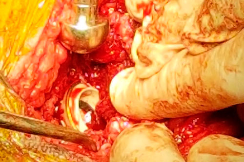 Imagen Trauma